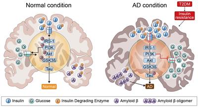 Role of DPP-4 and SGLT2 Inhibitors Connected to Alzheimer Disease in Type 2 Diabetes Mellitus